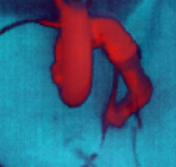 Ferret Thermal